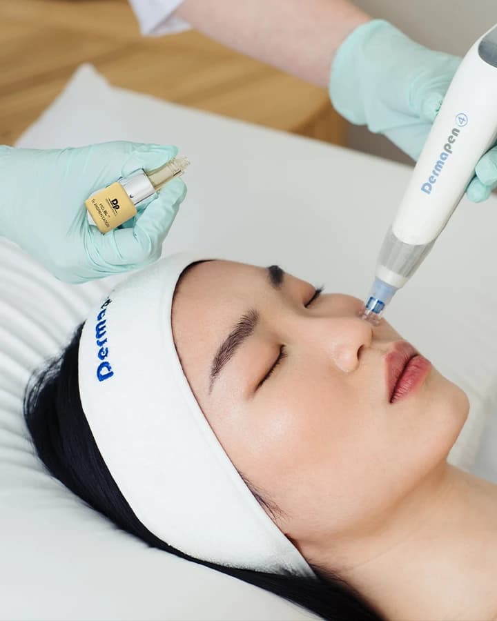 Derma Pen Hair Treatment