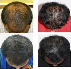 Q678 Hair Treatment